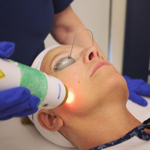 Reversing Sun Damage & Signs of Aging Caused by UV Exposure with Laser Therapy